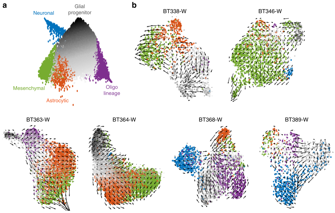 膠質(zhì)母細(xì)胞瘤RNA速度分析 膠質(zhì)母細(xì)胞瘤RNA速度分析