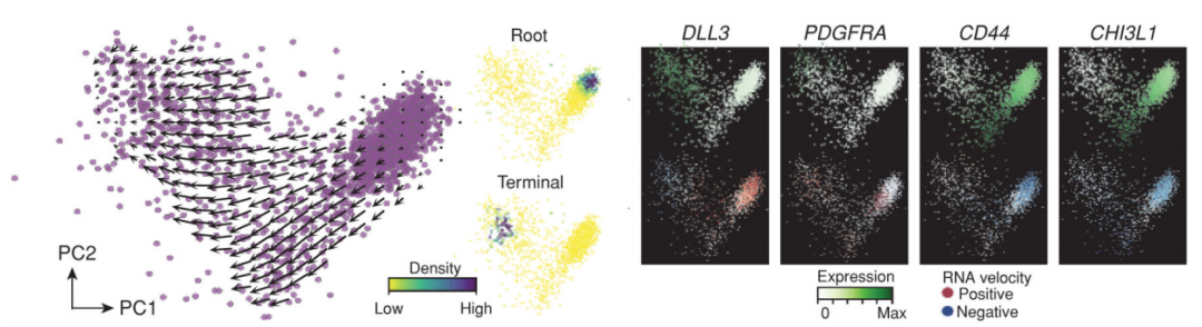 膠質(zhì)母細(xì)胞瘤干細(xì)胞樣細(xì)胞分化軌跡 膠質(zhì)母細(xì)胞瘤干細(xì)胞樣細(xì)胞分化軌跡
