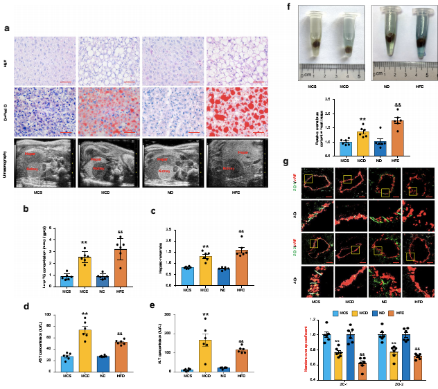 NAFLD小鼠冠狀動脈微血管內(nèi)皮通透性增強