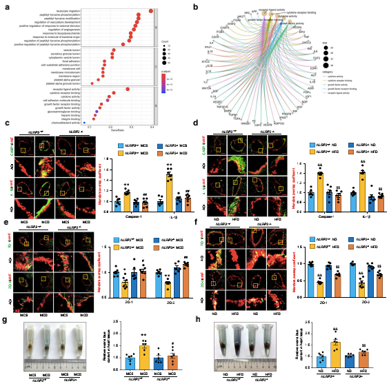 NLRP3炎癥小體介導NAFLD小鼠冠狀動脈微血管內(nèi)皮高通透性