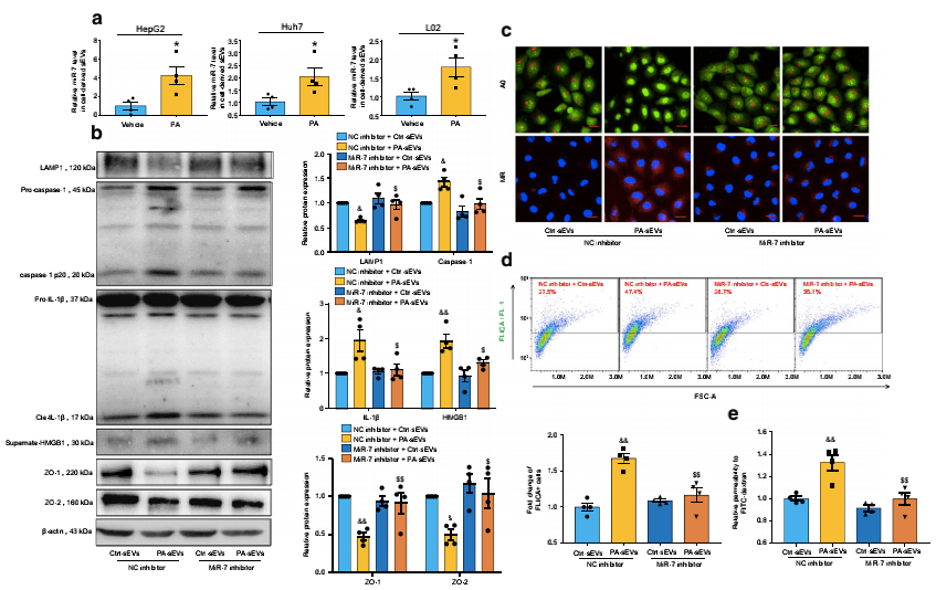 novel-miR-7的基因抑制可改善NAFLD肝源性外泌體誘導的微血管內(nèi)皮高通透性