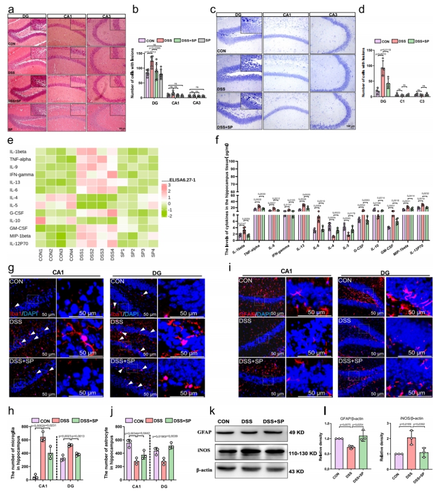圖2 SP減輕DSS誘導(dǎo)小鼠的海馬損傷及神經(jīng)炎癥反應(yīng)