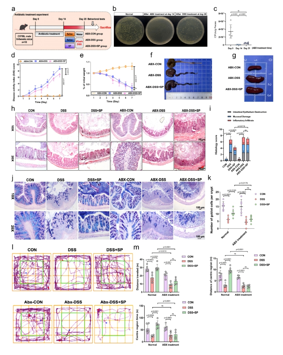圖4 SP以腸道微生物群依賴性方式預(yù)防DSS誘導(dǎo)的腸道損傷及焦慮樣障礙